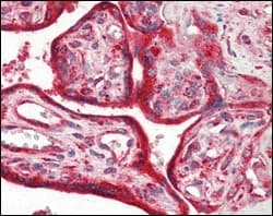 Monoclonal Mouse anti-Human CALR / Calreticulin Antibody (clone 1G6A7, aa405-417, IHC, IF, WB)