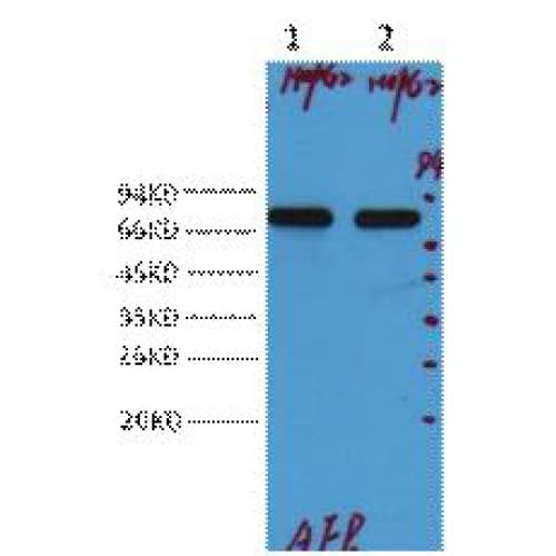 Monoclonal Mouse anti-Human Alpha-Fetoprotein Antibody (clone 17C5, WB)