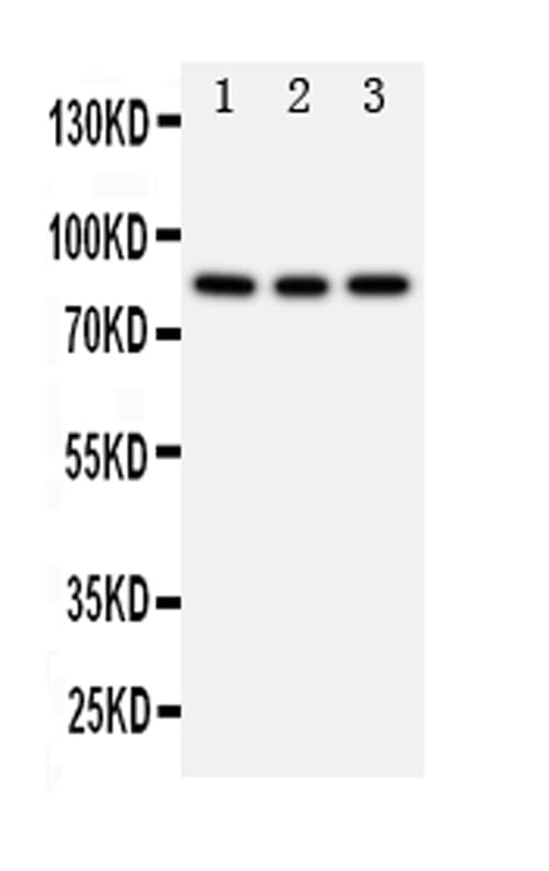 PIK3R2 / p85 Beta Antibody (aa447-461)