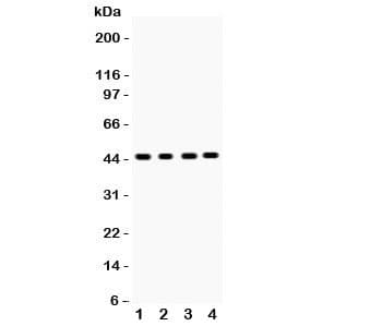 SERPINB5 / Maspin Antibody (aa1-350)