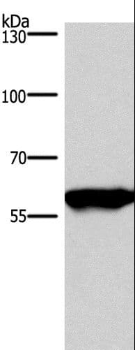 PPP3CA / CCN1 / Calcineurin A Antibody