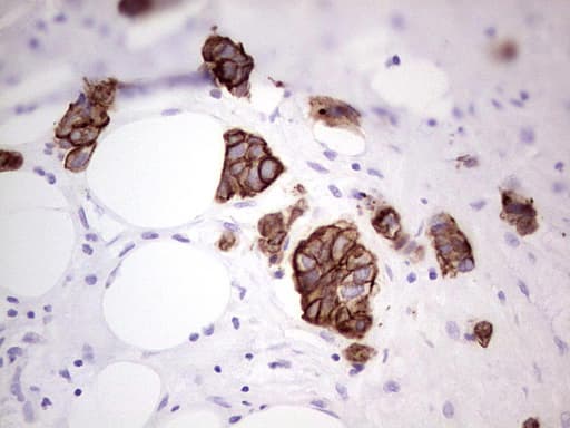 Monoclonal Mouse anti-Human Acidic Cytokeratin AE1 Antibody (clone AE1, IHC)