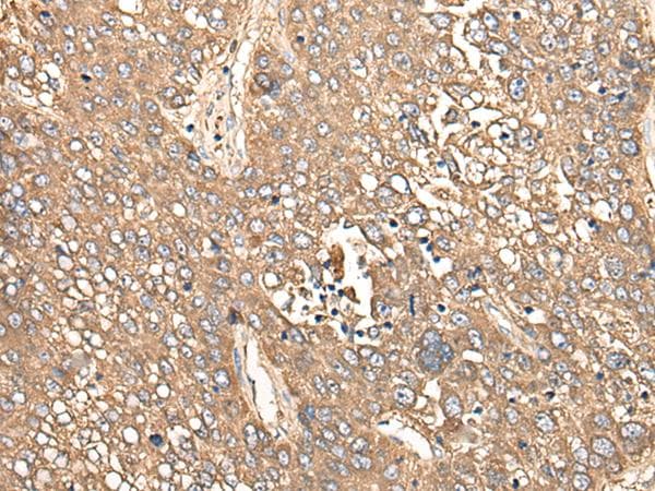 CALB1 / Calbindin Antibody