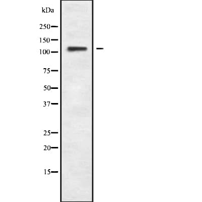 Polyclonal Rabbit anti-Human SUGP2 / SFRS14 Antibody (IF, WB)