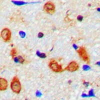 SYT1 / Synaptotagmin Antibody (Internal)