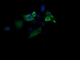 MAP2K1 / MKK1 / MEK1 Antibody (clone OTI2H3, Carrier-free)