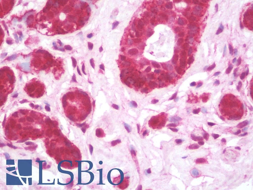 IHC-plus™ Polyclonal Rabbit anti-Human AMIGO Antibody (IHC, IF, WB)