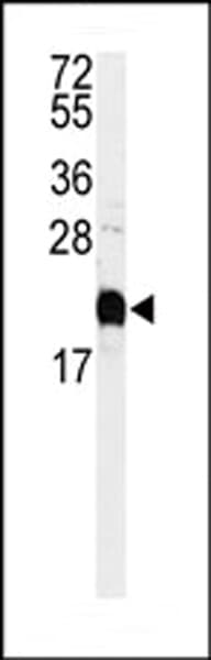 CALM1 / Calmodulin Antibody (aa117-149)