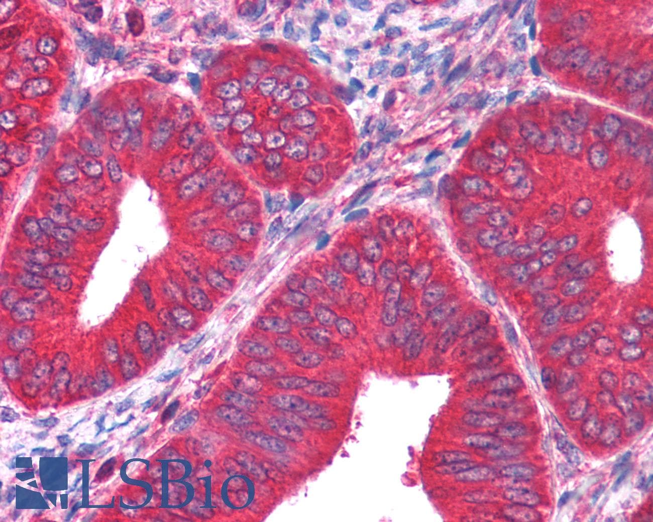 IHC-plus™ Polyclonal Goat anti-Rabbit PKM / Pyruvate Kinase, Muscle Antibody (IHC, WB)