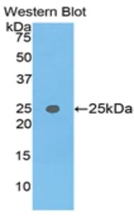 TNPO1 / Transportin 1 Antibody (aa626-836)
