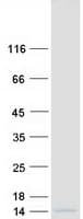 Human RPS27L Protein (Recombinant Myc-DDK (Flag))
