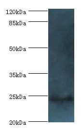 FKBP25 / FKBP3 Antibody (aa2-224)