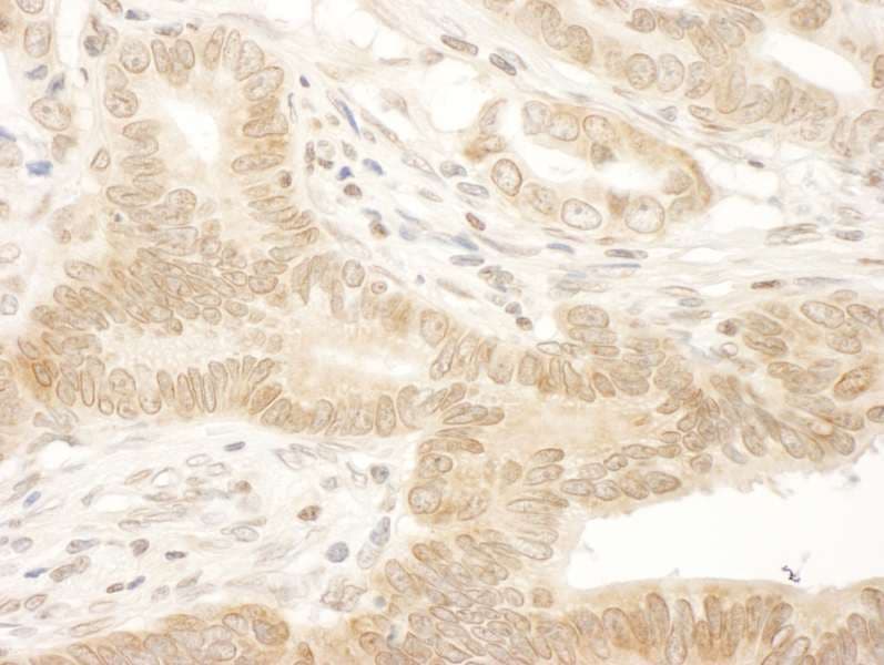 Polyclonal Rabbit anti-Human NARG1 / NAA15 Antibody (aa816-866, IHC)