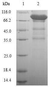 Human RYR3 / Ryanodine Receptor 3 Protein (Recombinant 6His, N-terminus)