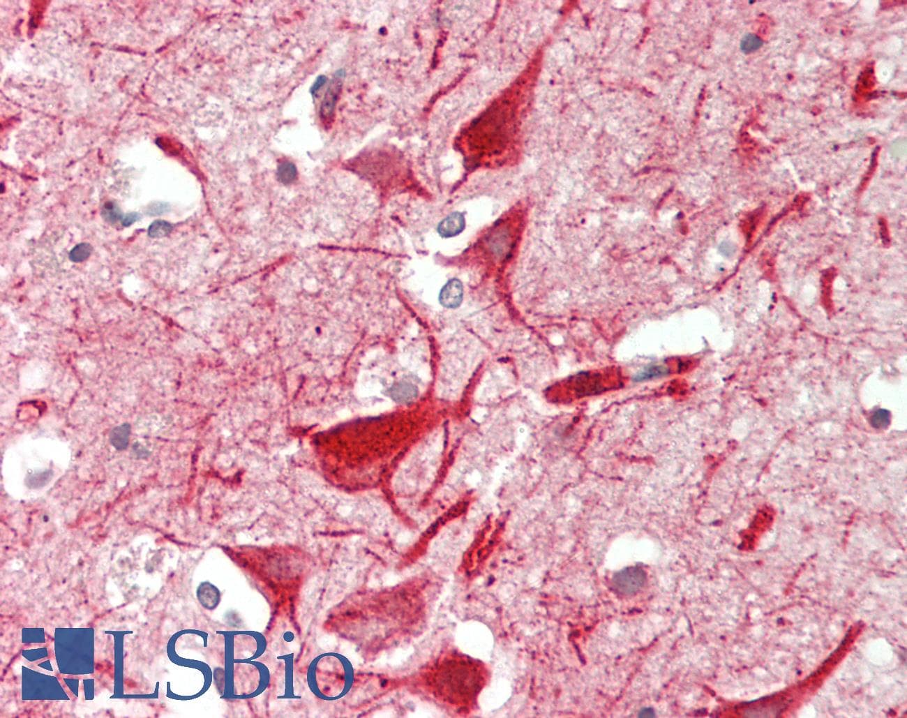 IHC-plus™ Polyclonal Rabbit anti-Human METTL13 / KIAA0859 Antibody (aa650-700, IHC, WB)