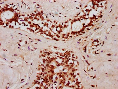 SMC1B Antibody