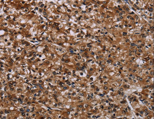 Polyclonal Rabbit anti-Human KDM3B / JMJD1B Antibody (IHC)