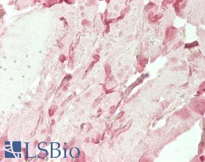 IHC-plus™ COL1A2 / Collagen I Alpha 2 Antibody (aa452-501)