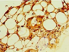 PSCA Antibody (aa12-114)