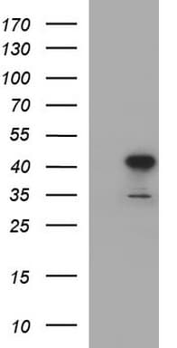 HAUS7 Antibody (clone OTI1E8)