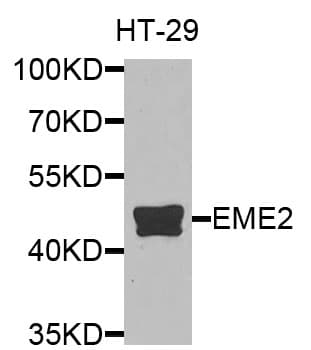 Polyclonal Rabbit anti-Human EME2 Antibody (WB)