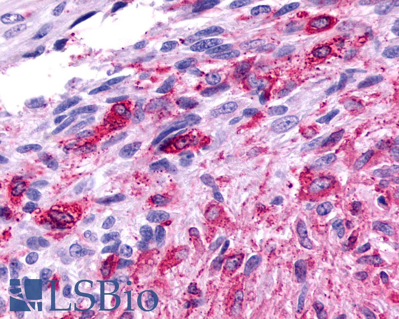IHC-plus™ Polyclonal Rabbit anti-Human FZD2 / Frizzled 2 Antibody (N-Terminus, IHC)