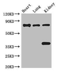 KIAA1811 / BRSK1 Antibody