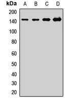 Polyclonal Rabbit anti-Human WDR33 Antibody (WB)