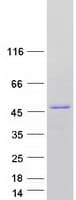 Human TMOD1 / Tropomodulin 1 Protein (Recombinant Myc-DDK (Flag))
