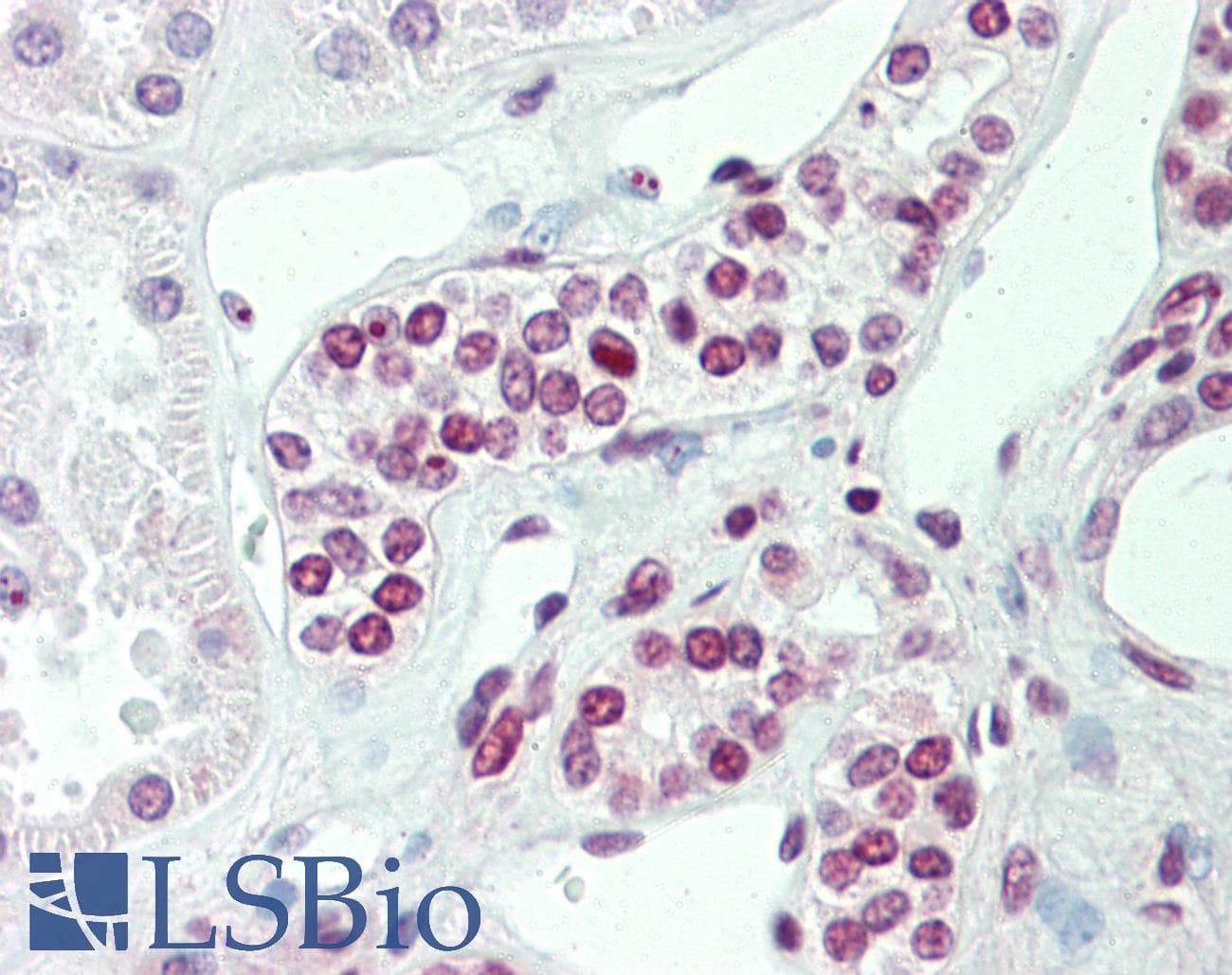 IHC-plus™ Polyclonal Goat anti-Human MAPKAPK5 / PRAK Antibody (aa192-206, IHC, WB)