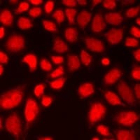 PathPlus™ SFN / Stratifin / 14-3-3 Sigma Antibody