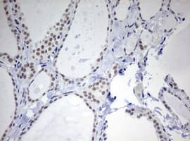 TOP2A / Topoisomerase II Alpha Antibody (aa1100-1531, clone OTI2A9)