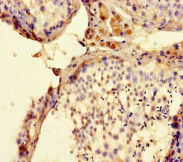 Polyclonal Rabbit anti-Human FAM71F2 Antibody