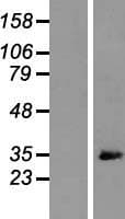 ARPC2 / p34-Arc Protein (Over-Expression Lysate Myc-DDK (Flag))