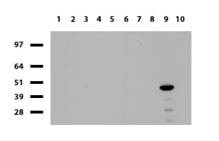 IHC-plus™ HAO1 Antibody (clone UMAB117)