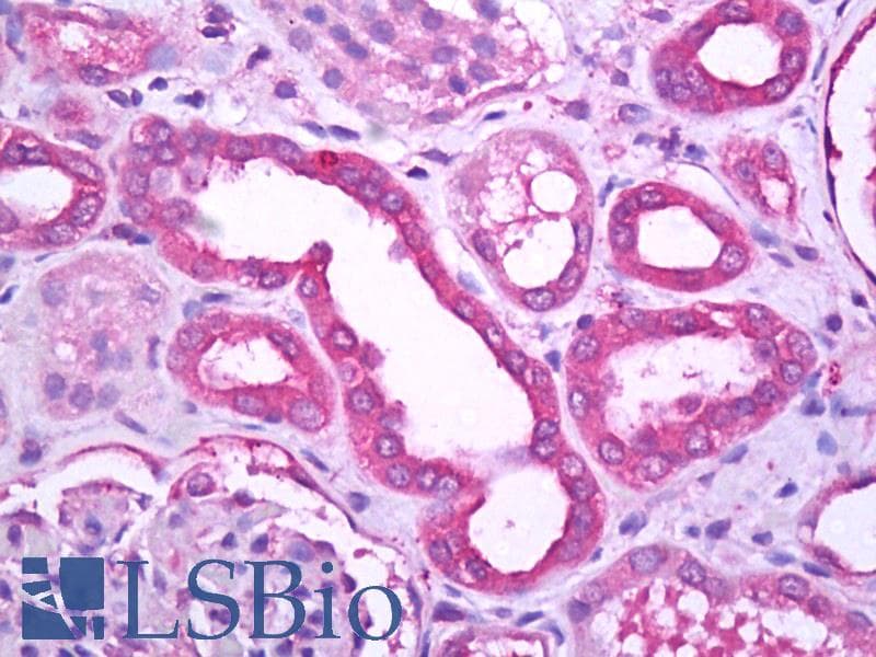 IHC-plus™ TRPM7 Antibody (C-Terminus)