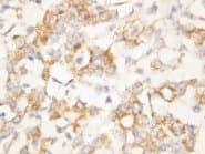 KRT8 / CK8 / Cytokeratin 8 Antibody (N-Terminus)