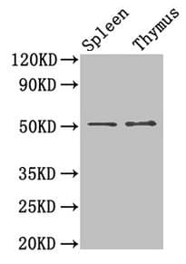 TUBB3 / Tubulin Beta 3 Antibody