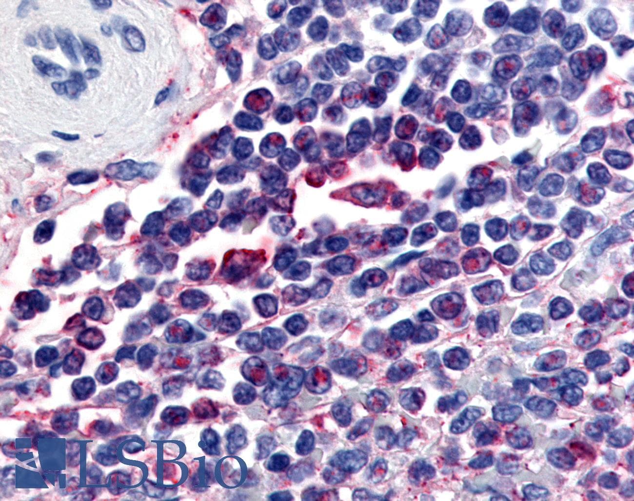 IHC-plus™ ATRN / Attractin Antibody (Internal)