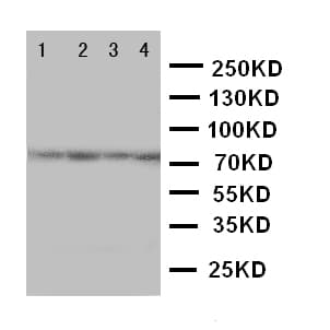PAK6 Antibody (aa16-32)