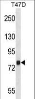 ZC3H14 Antibody (aa401-429)
