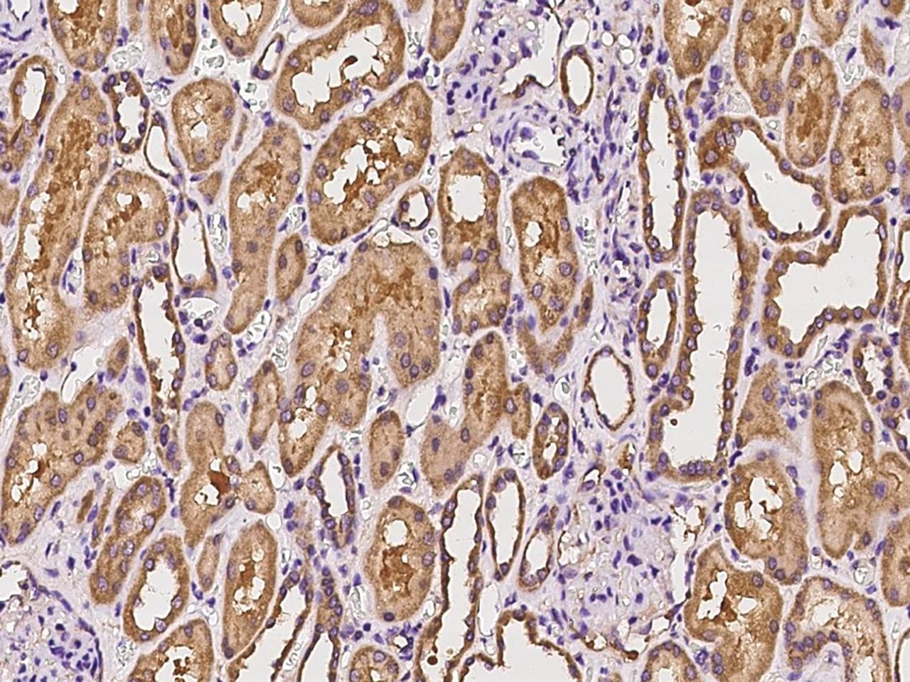 MRPL19 Antibody