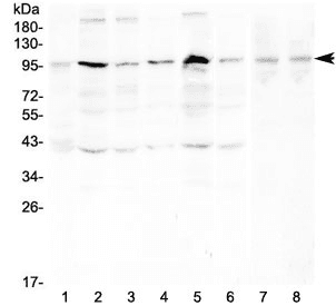 Polyclonal Rabbit anti-Human RPS6KA2 / RSK3 Antibody (WB)