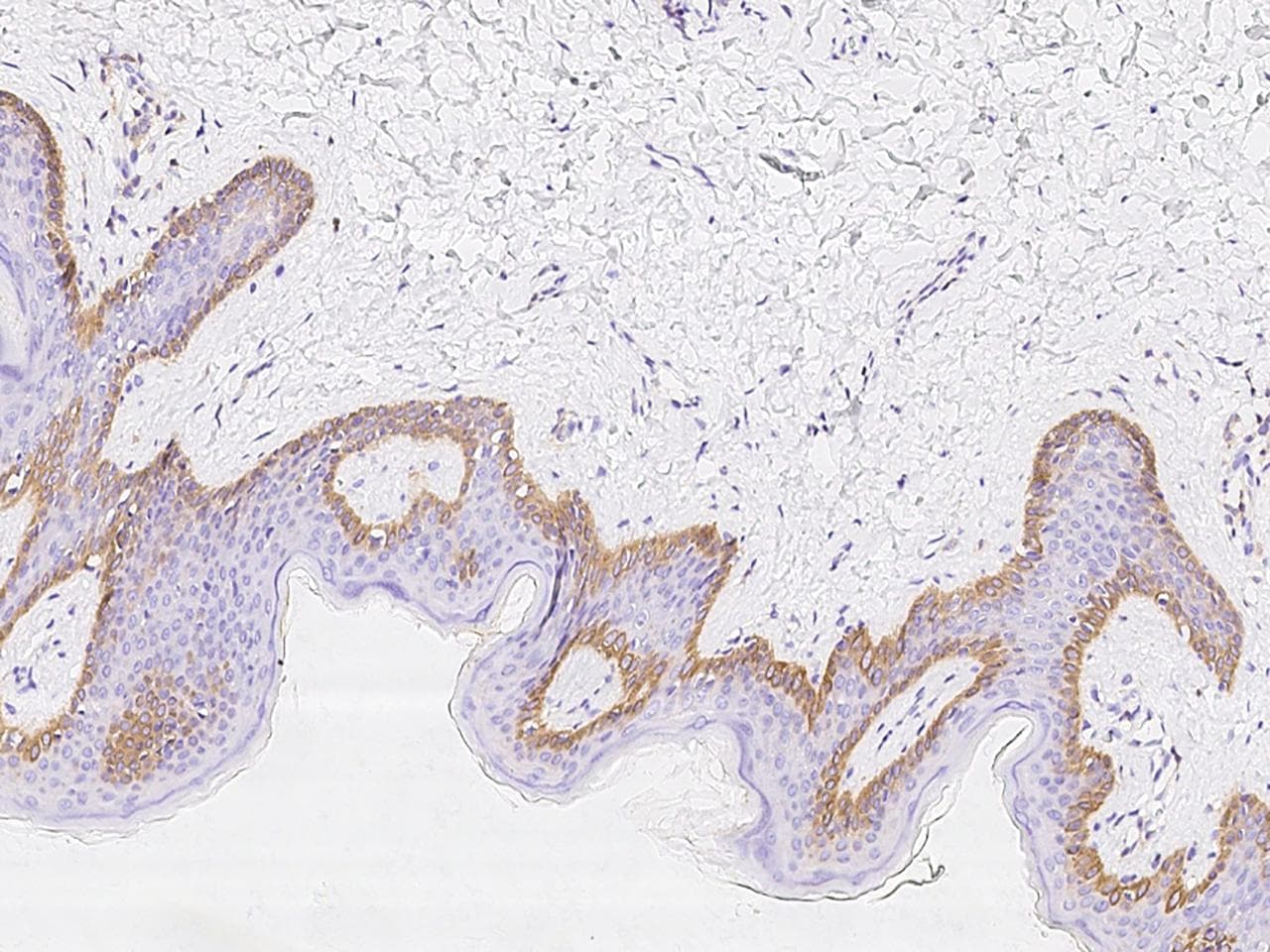 KRT76 / Keratin 76 Antibody