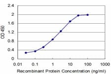 Neuropeptide Y / NPY Antibody (clone 3F11)