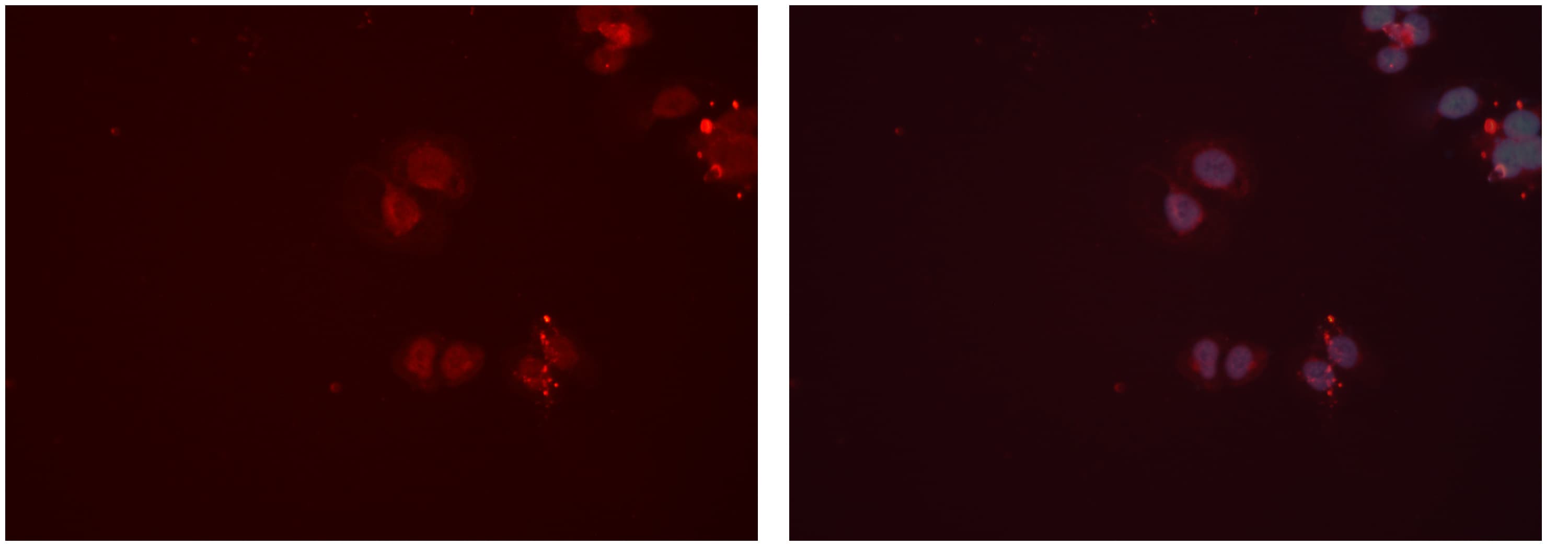 Polyclonal Rabbit anti-Human CPT2 Antibody (IHC, IF, WB)