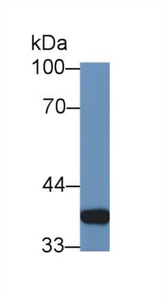 GAL4 / Galectin 4 Antibody (aa19-324, Cy3)