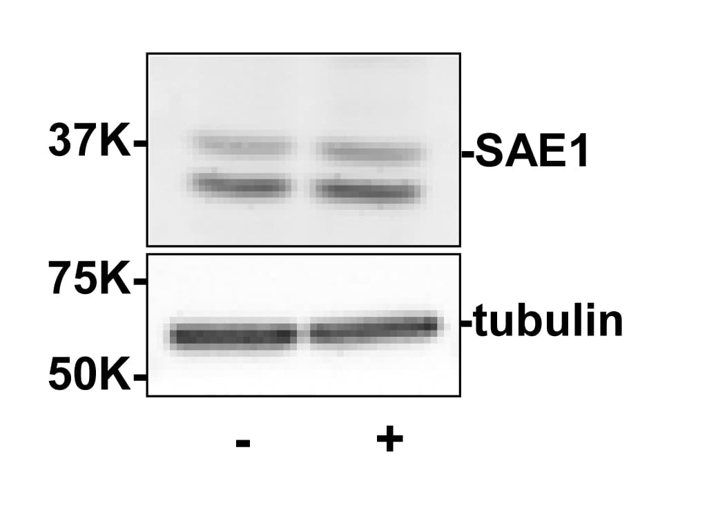SAE1 Antibody
