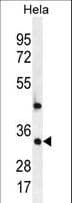 MED7 / CRSP9 Antibody (aa83-111)