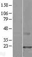 CMTM3 Protein (Over-Expression Lysate Myc-DDK (Flag))